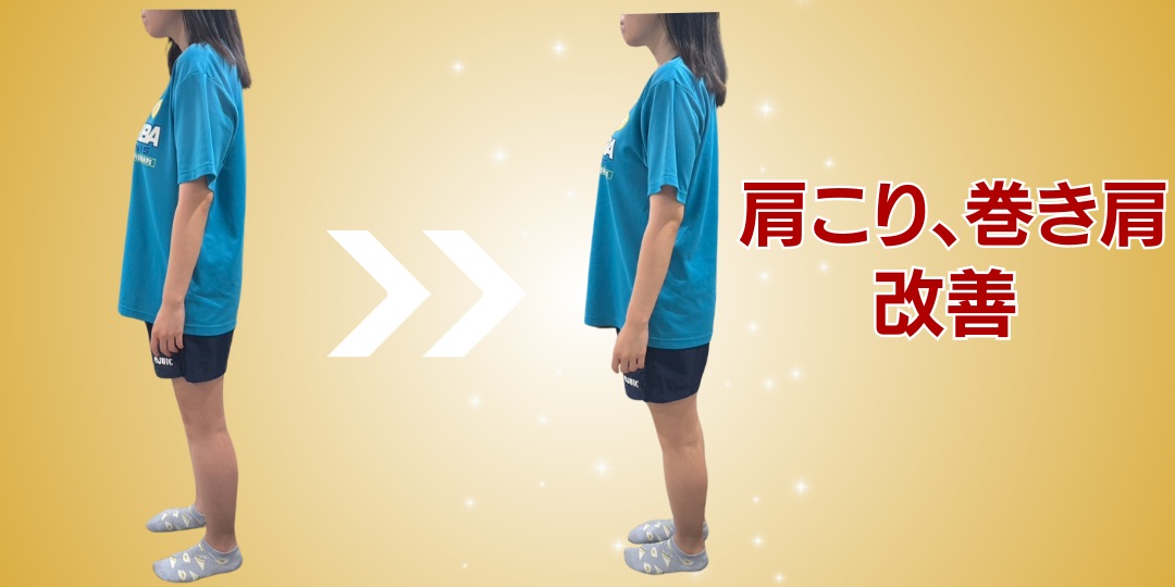 20代女性 姿勢改善 Before After 肩こり・巻き肩改善